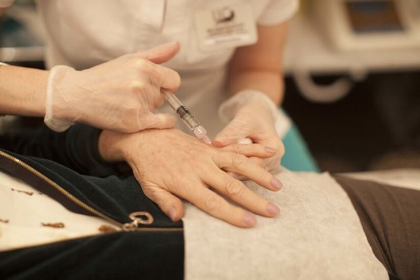 injekcijsko podmlađivanje kože ruku